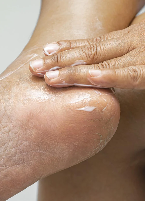 Lar e Lazer - Creme de Ureia 10% 400g 3